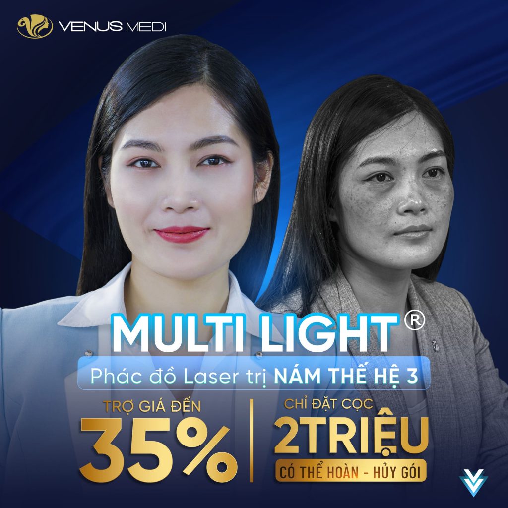 Multi-Light® Phác đồ Laser Trị nám thế hệ 3