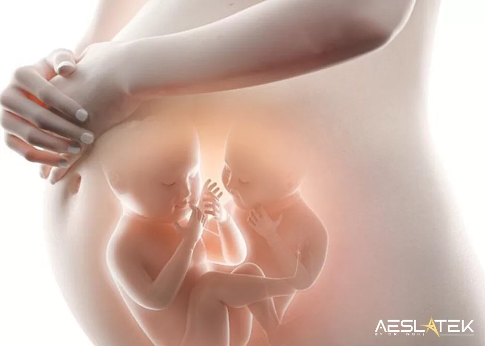 Đa thai có thể gây bệnh lý u máu ở trẻ sơ sinh
