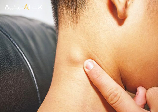 U máu có chữa được không? Điều trị u máu như thế nào? 3 Tuỳ vào trạng thái bệnh cụ thể bác sĩ sẽ đưa ra phương pháp chữa trị phù hợp