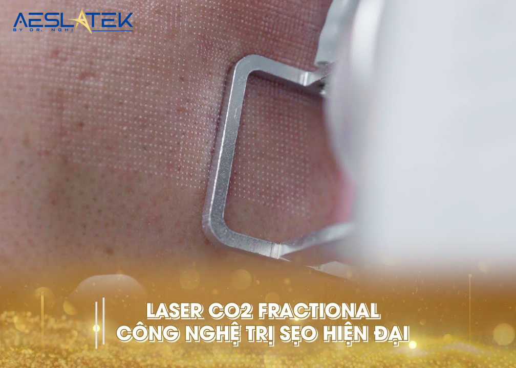 Hạn chế tối đa sẹo lồi tái phát với công nghệ Laser Co2