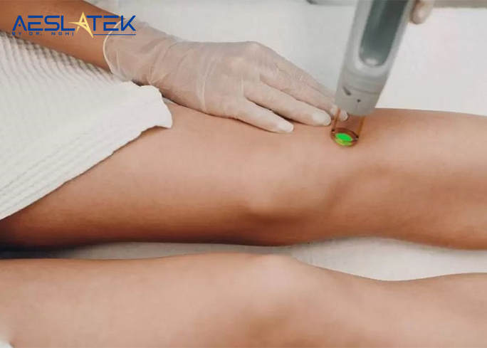 Bật mí cách trị sẹo lồi đầu gối hiệu quả giúp chị em tự tin 2 Điều trị sẹo lồi ở đầu gối hiệu quả hơn với công nghệ hiện đại
