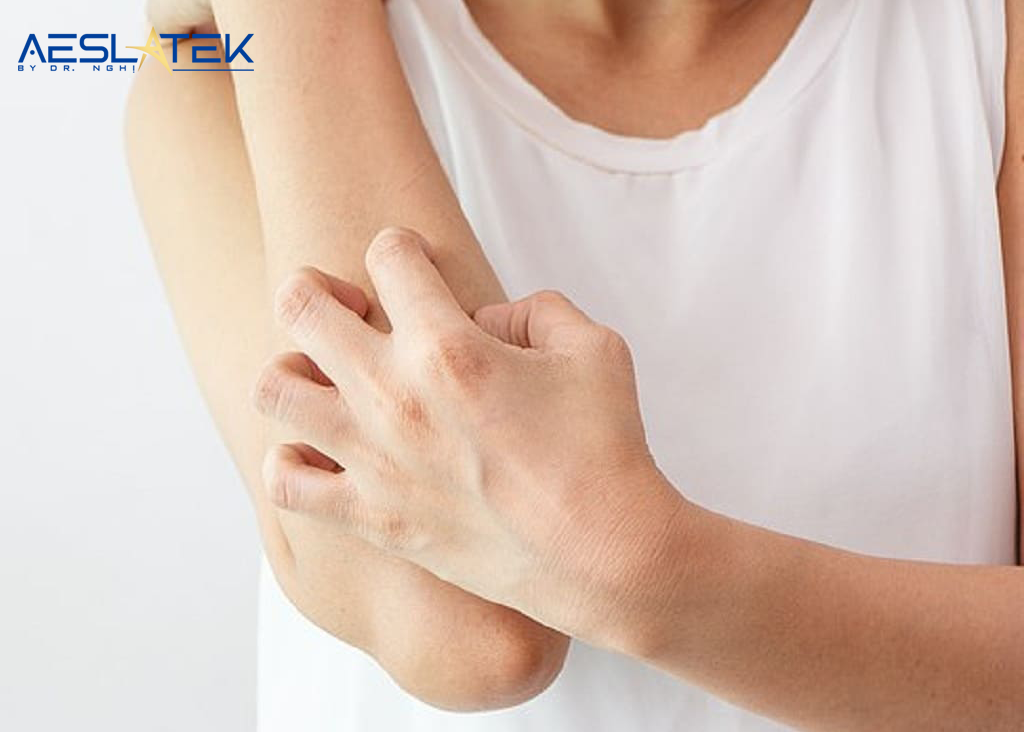 Sẹo lồi ngứa và đau - Nguyên nhân và cách khắc phục triệt để 1 Làm sao khi sẹo lồi bị ngứa và đau?