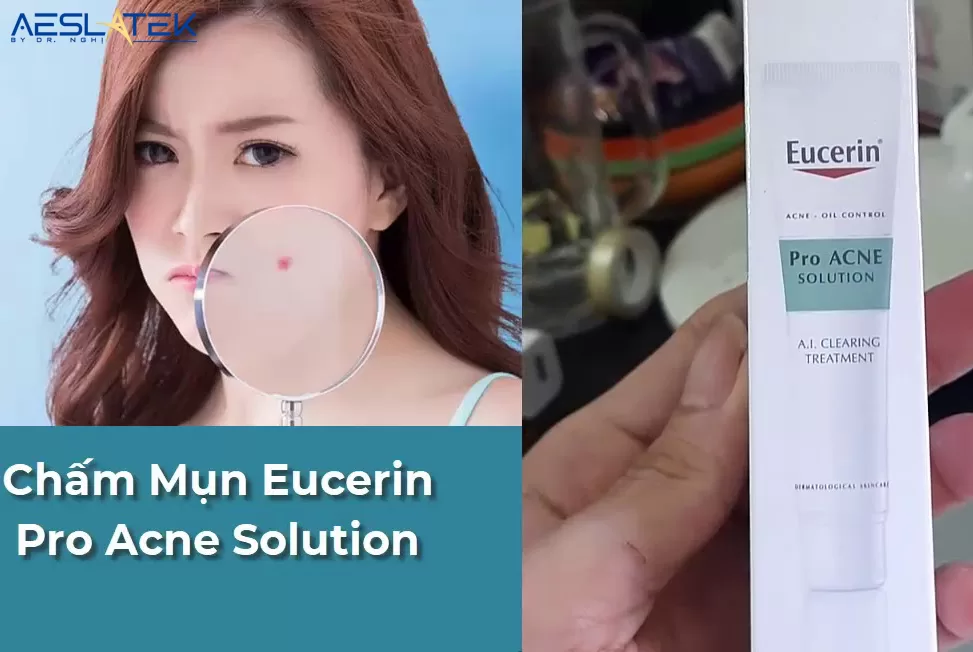 Eucerin có nhiều ưu điểm trong việc điều trị mụn trên da