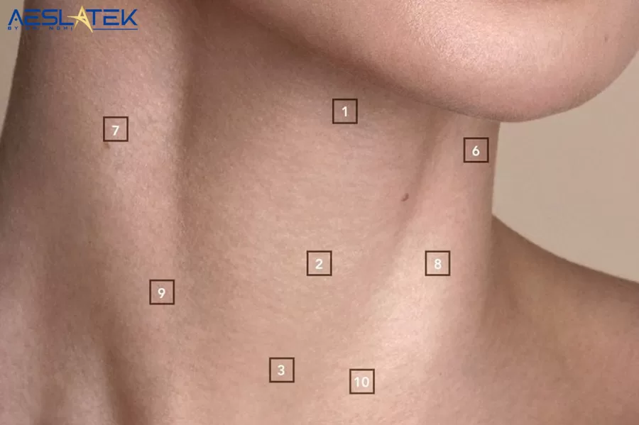 Các điểm tiêm ở vùng da cổ cần được xác định cẩn trọng, chính xác