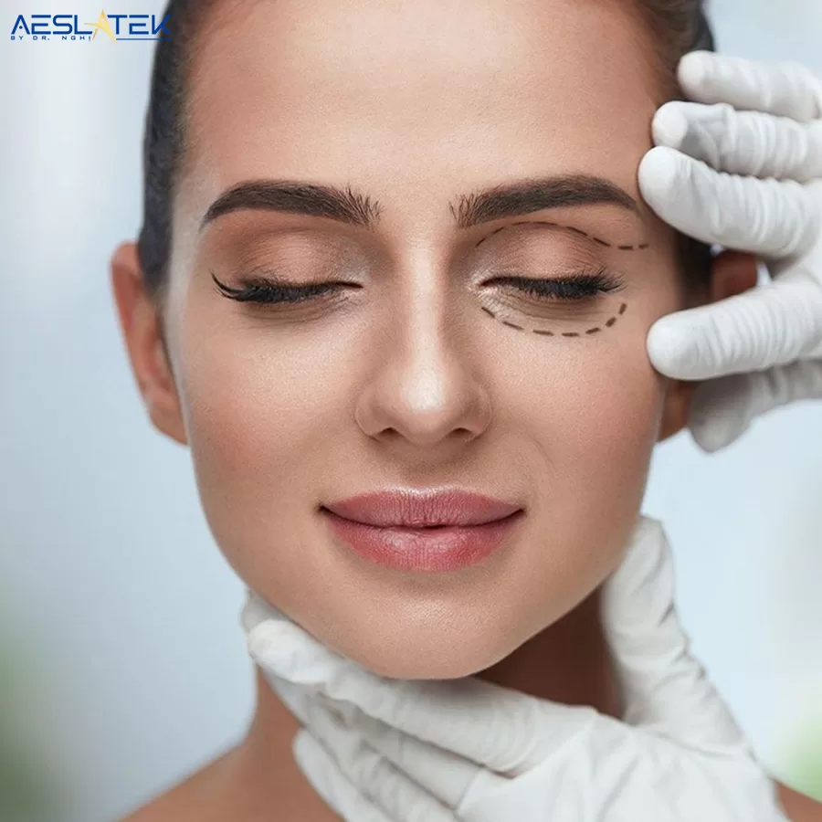 Phương pháp cải thiện các khuyết điểm tại vùng da quanh mắt