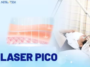 Laser Pico cho hiệu quả điều trị đốm sắc tố rõ rệt ngay sau liệu trình