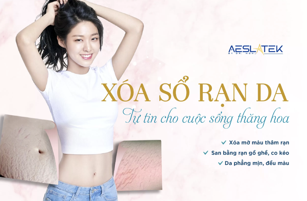 Xóa rạn da hiệu quả tại Aeslatek