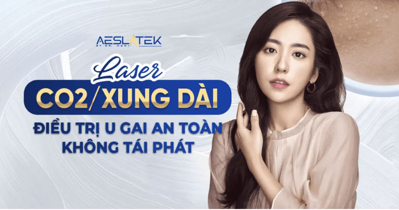 Điều trị u gai